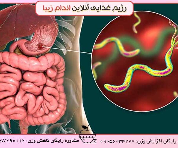 بایدها و نبایدهای زخم معده