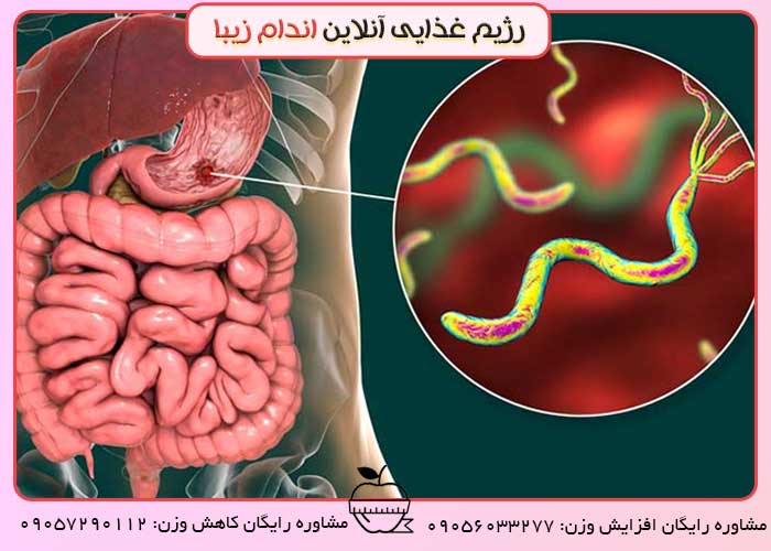 بایدها و نبایدهای زخم معده